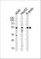 Activin A Receptor Type 1 antibody, A00798-3, Boster Biological Technology, Western Blot image 
