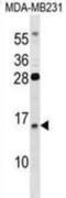 Guanylate Cyclase Activator 2B antibody, abx028792, Abbexa, Western Blot image 
