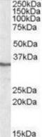 Protein Phosphatase 4 Catalytic Subunit antibody, NBP1-50579, Novus Biologicals, Western Blot image 