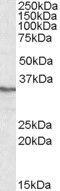 Protein Phosphatase 4 Catalytic Subunit antibody, GTX88412, GeneTex, Western Blot image 