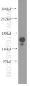 Nuclear Autoantigenic Sperm Protein antibody, 11323-1-AP, Proteintech Group, Western Blot image 