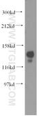 Nuclear Autoantigenic Sperm Protein antibody, 11323-1-AP, Proteintech Group, Western Blot image 