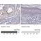 Acyl-CoA Synthetase Long Chain Family Member 6 antibody, NBP1-89269, Novus Biologicals, Immunohistochemistry paraffin image 