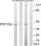 Protein Phosphatase 1 Regulatory Inhibitor Subunit 2 antibody, LS-C199490, Lifespan Biosciences, Western Blot image 