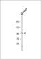 Mindbomb E3 Ubiquitin Protein Ligase 2 antibody, PA5-72307, Invitrogen Antibodies, Western Blot image 