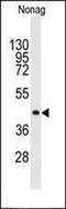 Myristoylated Alanine Rich Protein Kinase C Substrate antibody, orb331095, Biorbyt, Western Blot image 