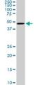 SMAD Family Member 3 antibody, H00004088-M07, Novus Biologicals, Western Blot image 