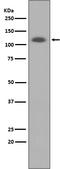 ATP Binding Cassette Subfamily G Member 1 antibody, M01227, Boster Biological Technology, Western Blot image 