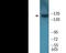 Insulin Receptor antibody, EKC2076, Boster Biological Technology, Western Blot image 