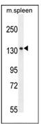 Cell Migration Inducing Hyaluronidase 1 antibody, AP52281PU-N, Origene, Western Blot image 