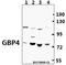 Guanylate Binding Protein 4 antibody, A11011-1, Boster Biological Technology, Western Blot image 