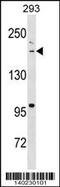 Bromodomain Adjacent To Zinc Finger Domain 1B antibody, 60-467, ProSci, Western Blot image 