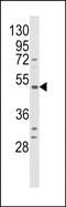 Bradykinin Receptor B1 antibody, PA5-72564, Invitrogen Antibodies, Western Blot image 