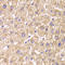 ST3 Beta-Galactoside Alpha-2,3-Sialyltransferase 3 antibody, LS-C334922, Lifespan Biosciences, Immunohistochemistry frozen image 