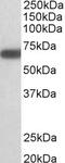 ATP/GTP Binding Protein Like 5 antibody, 42-858, ProSci, Western Blot image 