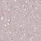 Collagen Type VIII Alpha 1 Chain antibody, PA5-62731, Invitrogen Antibodies, Immunohistochemistry paraffin image 