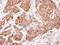 ADP Ribosylation Factor 5 antibody, NBP1-31005, Novus Biologicals, Immunohistochemistry paraffin image 