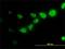 Calpain Small Subunit 1 antibody, H00000826-M01, Novus Biologicals, Immunocytochemistry image 