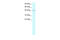 Zinc Finger Protein 207 antibody, 27-886, ProSci, Western Blot image 