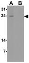 Interleukin 36 Receptor Antagonist antibody, GTX31556, GeneTex, Western Blot image 