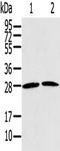 RAS Related 2 antibody, TA350377, Origene, Western Blot image 