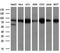 Aconitase 2 antibody, GTX84965, GeneTex, Western Blot image 