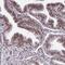 Homeobox A4 antibody, PA5-63814, Invitrogen Antibodies, Immunohistochemistry paraffin image 