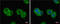 Anti-Mullerian Hormone antibody, GTX129593, GeneTex, Immunocytochemistry image 