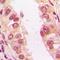 Trafficking Regulator Of GLUT4 (SLC2A4) 1 antibody, orb315736, Biorbyt, Immunohistochemistry paraffin image 