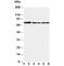 B-Raf Proto-Oncogene, Serine/Threonine Kinase antibody, R30946, NSJ Bioreagents, Western Blot image 
