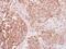 Insulin Receptor antibody, PA5-29286, Invitrogen Antibodies, Immunohistochemistry paraffin image 