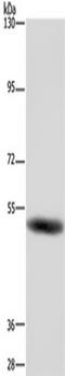 Gamma-Aminobutyric Acid Type A Receptor Beta1 Subunit antibody, TA350008, Origene, Western Blot image 