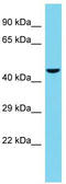 Tsukushi, Small Leucine Rich Proteoglycan antibody, TA331949, Origene, Western Blot image 