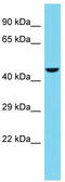 Tsukushi, Small Leucine Rich Proteoglycan antibody, TA331949, Origene, Western Blot image 