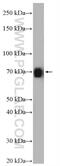 Small conductance calcium-activated potassium channel protein 1 antibody, 17929-1-AP, Proteintech Group, Western Blot image 