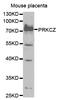 Protein Kinase C Zeta antibody, abx000871, Abbexa, Western Blot image 