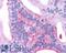 G Protein-Coupled Receptor 88 antibody, LS-A1572, Lifespan Biosciences, Immunohistochemistry frozen image 