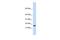 HECT And RLD Domain Containing E3 Ubiquitin Protein Ligase 4 antibody, GTX46941, GeneTex, Western Blot image 