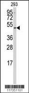 Small RNA Binding Exonuclease Protection Factor La antibody, MBS9202809, MyBioSource, Western Blot image 