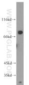 Tenascin XB antibody, 13595-1-AP, Proteintech Group, Western Blot image 