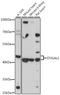 ST3 Beta-Galactoside Alpha-2,3-Sialyltransferase 2 antibody, A10700, Boster Biological Technology, Western Blot image 