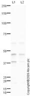 Damage Specific DNA Binding Protein 2 antibody, ab77765, Abcam, Western Blot image 