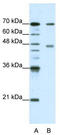Poly(A) Binding Protein Cytoplasmic 4 antibody, TA345861, Origene, Western Blot image 