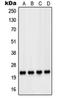 Parkinsonism Associated Deglycase antibody, orb215054, Biorbyt, Western Blot image 