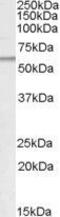 Patatin Like Phospholipase Domain Containing 2 antibody, GTX89133, GeneTex, Western Blot image 