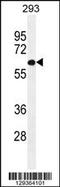 PAT1 Homolog 2 antibody, 55-819, ProSci, Western Blot image 