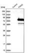 Phosphoglucomutase-2 antibody, NBP2-32601, Novus Biologicals, Western Blot image 