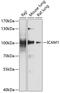 Intercellular Adhesion Molecule 1 antibody, GTX32663, GeneTex, Western Blot image 