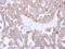 Chaperonin Containing TCP1 Subunit 8 antibody, GTX105725, GeneTex, Immunohistochemistry paraffin image 