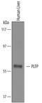 Phospholipid transfer protein antibody, AF5109, R&D Systems, Western Blot image 